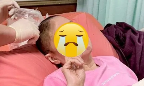 Nữ diễn viên truyền hình đình đám bàng hoàng vì bị mất 1 phần hộp sọ sau 5 ngày hôn mê