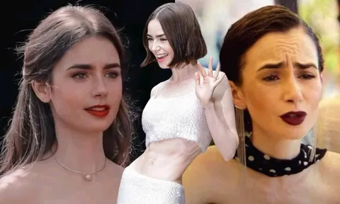 "Bạch Tuyết sống" của Hollywood tới tuổi 36 gầy trơ xương, nếp nhăn chồng chất vì lão hóa