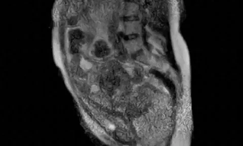 Người phụ nữ sinh con trong máy chụp cộng hưởng từ