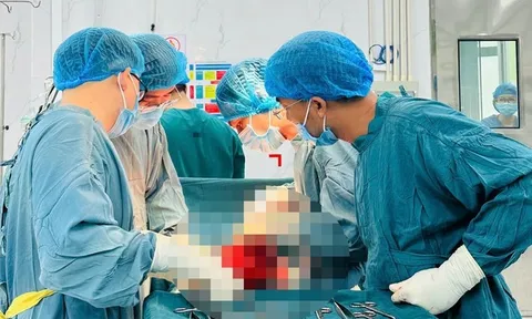 Chủ quan không điều trị, người phụ nữ mang khối u tử cung “khổng lồ” nhiều năm