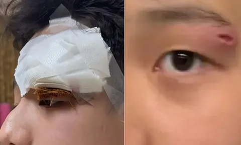 Một nữ diễn viên nổi tiếng làm 1 việc khiến con trai phải khâu tới 4 mũi