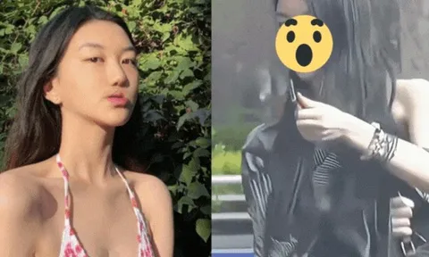 Con gái Vương Phi diện mạo khó tin sau 4 lần phẫu thuật hở hàm ếch, đã có bạn trai ở tuổi 20