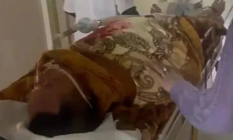 Người đàn ông nguy kịch nghi nhiễm liên cầu khuẩn lợn sau khi ăn tiết canh dê