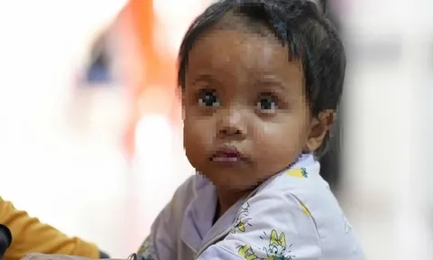 Bé gái bị nhiễm độc từ chính mình, đi 6 bệnh viện không phát hiện ra