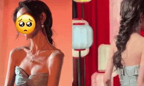 Hoảng hồn “em gái quốc dân” gầy trơ xương đến đáng sợ, phí cả gương mặt trời ban