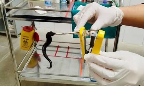 Đi khám, người đàn ông sốc nặng khi thấy thứ đáng sợ trong mũi mình