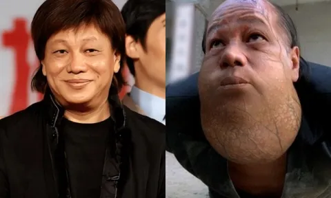 Nam nghệ sĩ nổi tiếng ai cũng nhớ mặt vừa đột ngột qua đời