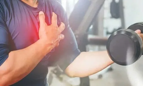 Dấu hiệu cảnh báo nên ngừng chơi thể thao để tránh đột quỵ