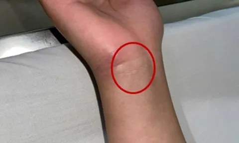 Bệnh viện Trung ương Quân đội 108 phát cảnh báo về 1 căn bệnh nguy hiểm, nhà nào cũng có nguy cơ mầm mống trú ngụ