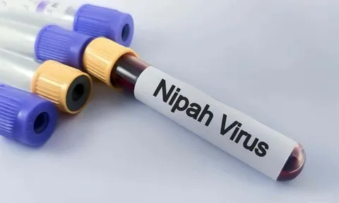 Vi rút Nipah nguy hiểm ra sao?