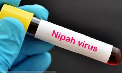 Bác sĩ Bệnh viện Chợ Rẫy chỉ ra 3 con đường lây truyền virus Nipah, nhắc mọi người hiểu đúng để cảnh giác “không hoang mang”