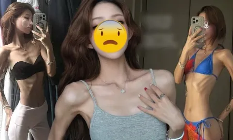 Phát sợ với cơ thể gầy trơ xương, héo mòn của con gái "nữ diễn viên quốc dân"
