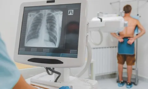 Chụp X-quang 'bấm là xong', sao phải chờ đủ 6 phút mới được BHYT thanh toán?