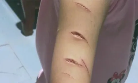 Chủ tịch Cà Mau chỉ đạo 'nóng', giao công an vào cuộc vụ học sinh bị rạch tay,