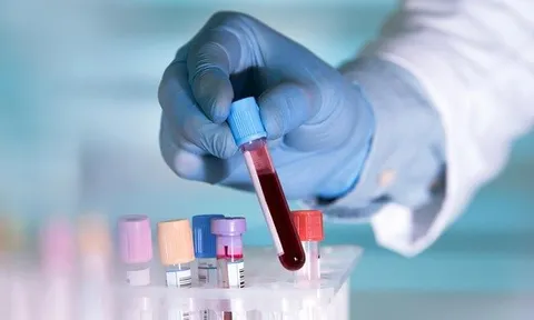 Xét nghiệm ung thư mới từ Mỹ có thể cứu nhiều người