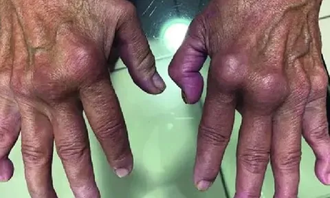 Nóng: Loại virus “phá hủy nội tạng” có thể chuẩn bị bùng phát