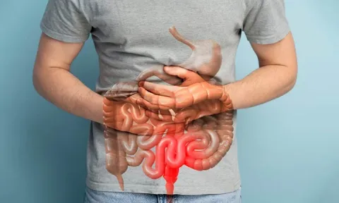 Số liệu mới đáng báo động về ung thư đại trực tràng: Người trẻ bị "nhắc tên"