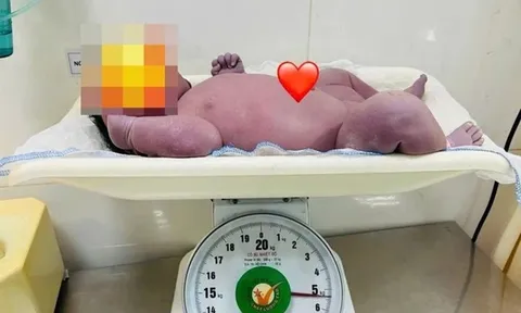 Mẹ trẻ ở Bắc Ninh sinh con trai nặng 5,4kg, bác sĩ bế ra cũng “mỏi tay”