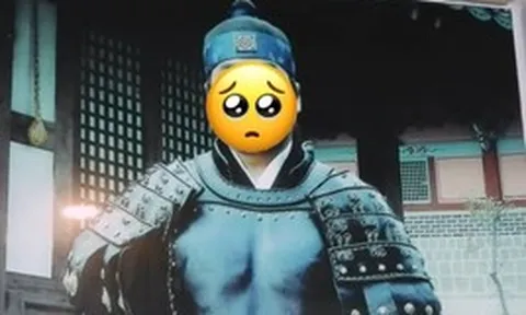 Sốc: Tài tử "Truyền Thuyết Jumong" mù mắt sau khi trượt chân ngã