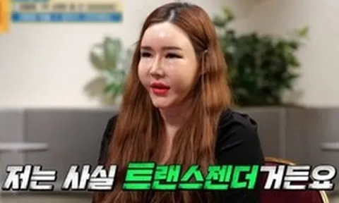 Sao chuyển giới chi 2,5 tỷ "dao kéo" toàn bộ gương mặt, 2 lần chia tay bạn trai trong nước mắt vì không thể sinh con