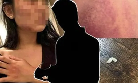 Sao nam ra tay hành hung phụ nữ bị tạm giam 30 ngày sau khi trình diện cảnh sát, các ông bầu hủy show hàng loạt