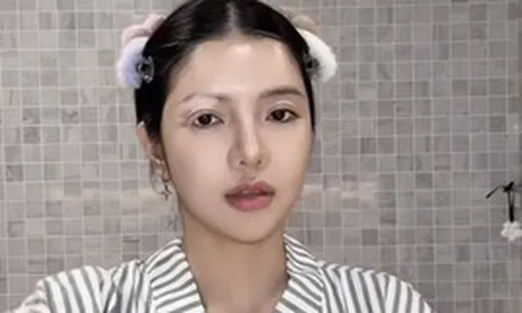 Mỹ nhân Việt mắc bệnh hiếm chỉ 2% dân số thế giới gặp phải