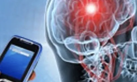 Bệnh u não có liên quan đến sóng điện thoại?