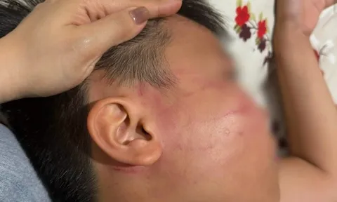 Vụ nam sinh lớp 4 bị giáo viên đánh bầm mặt: Bất ngờ phát hiện lớp dạy thêm tiếng Anh “chui”