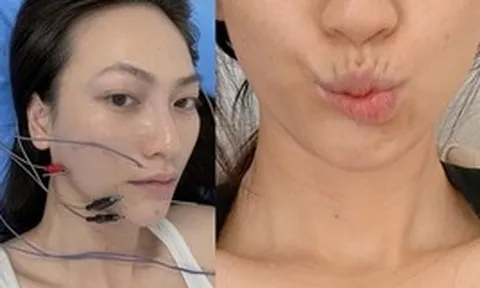Nữ chính phim trăm tỷ của Trấn Thành: Từng đi bán xôi lề đường, bị biến chứng sau ca mổ tuyến giáp