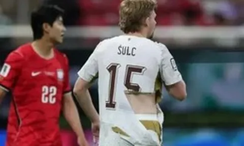 Tại sao áo đấu ở World Cup hay bị rách tả tơi?
