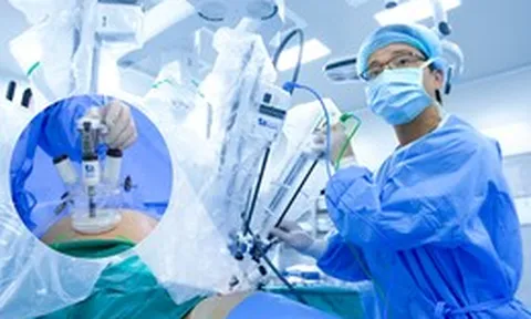Ứng dụng robot phẫu thuật ‘một cổng’ điều trị ung thư tại Việt Nam