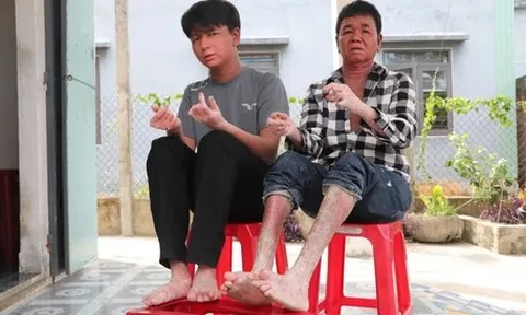 24 tuổi đời tràn ngập đau đớn, nam sinh 'người rắn' dũng cảm bước vào đại học