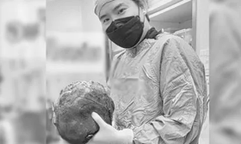 Bác sĩ sững người trước "thứ đáng sợ" trong bụng bệnh nhân