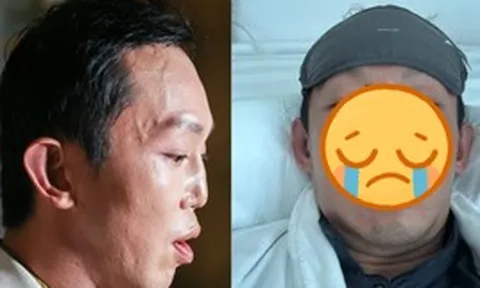 Nam thần màn ảnh vỡ nát mặt mũi sau vụ bị xe tông, tốn 13 tỷ sửa dung mạo bố mẹ vẫn nhận không ra
