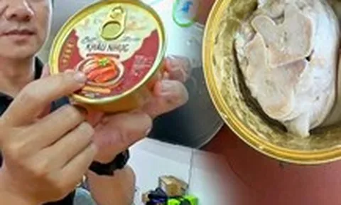 Cơ quan chức năng vào cuộc vụ đặt khâu nhục trên mạng 'nhận về hai cục xương'