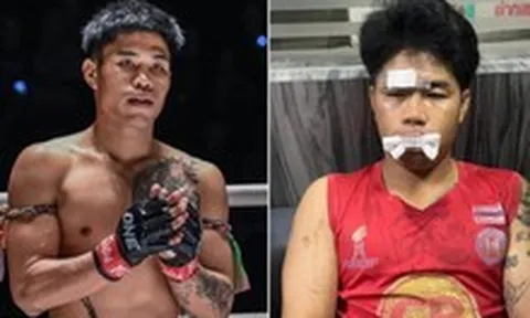 Bị tấn công trên đường, võ sĩ Muay Thái gãy răng, phải khâu 9 mũi trên mặt